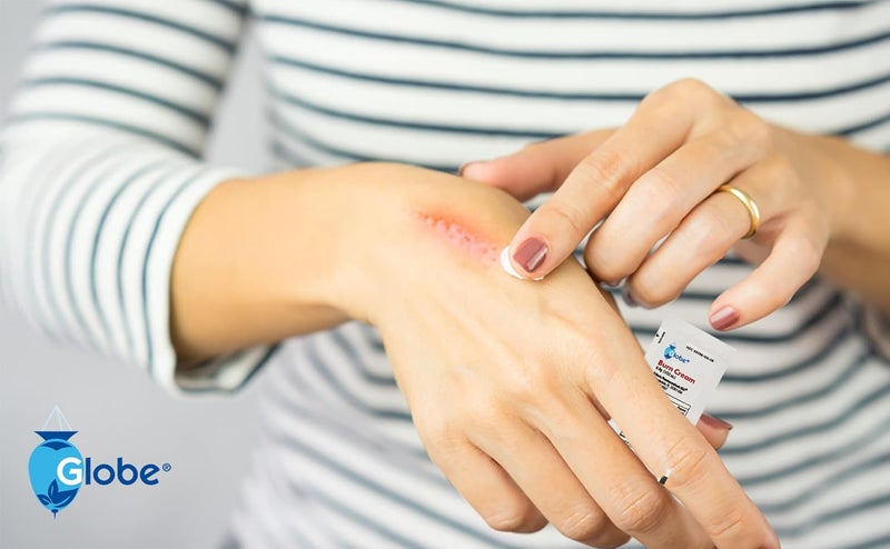 Globe First Aid Burn Cream 0.9g Packets, (Box of 144) Advanced First Aid Cream for Temporary Relief of Minor Burns, Cuts, and Scrapes - Image 3